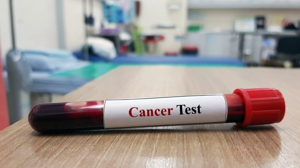 腫瘤標記抽血