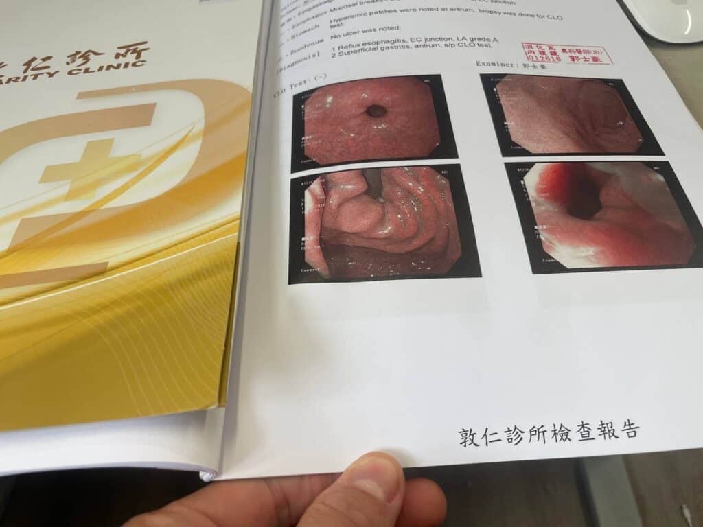 敦仁診所：大腸鏡檢查報告