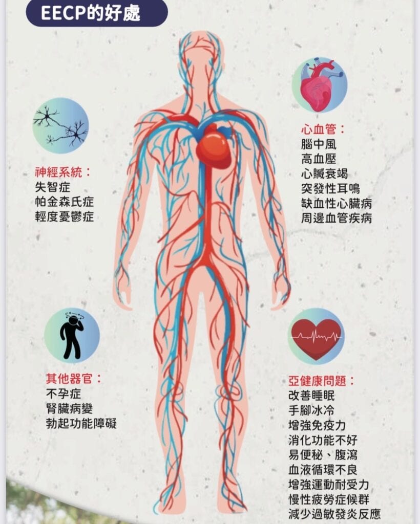 EECP對心臟問題與心血管的好處