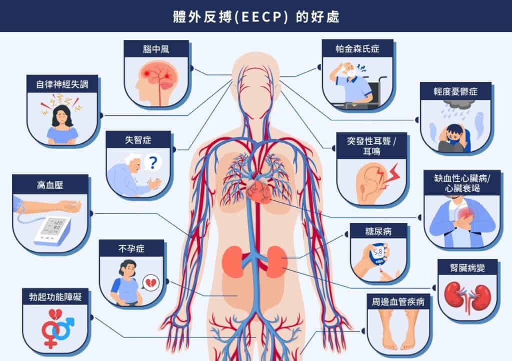 EECP的好處