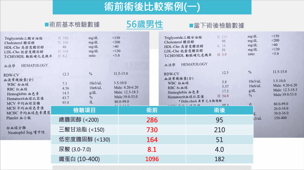 血漿置換術的術前與術後血液報告比較