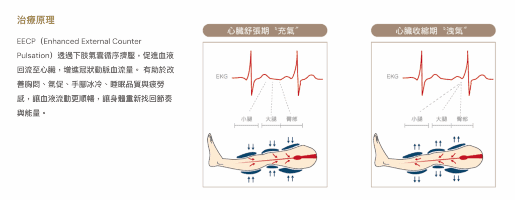 EECP治療原理圖解