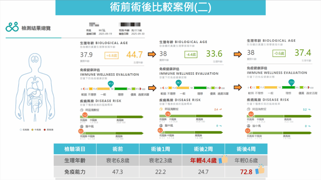 血漿置換術的術前與術後比較生理年齡與免疫能力