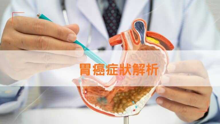 胃癌症狀解析