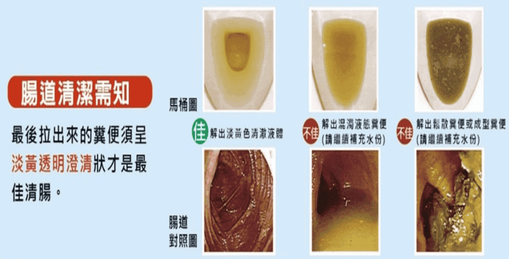 大腸鏡檢查前清腸準備與清腸藥服用時間點