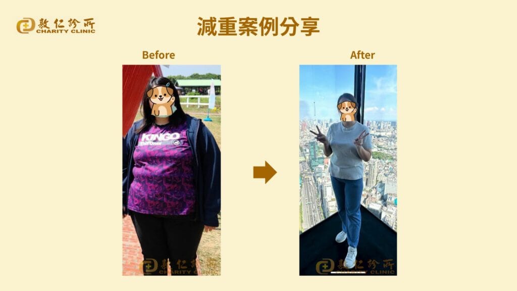 敦仁診所門診個案－呂小姐，減下 58 公斤，內臟脂肪 8.59→5.5