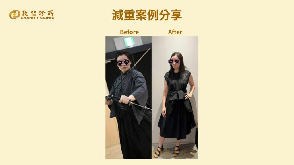 敦仁診所門診個案－巧儀－8週減14公斤
