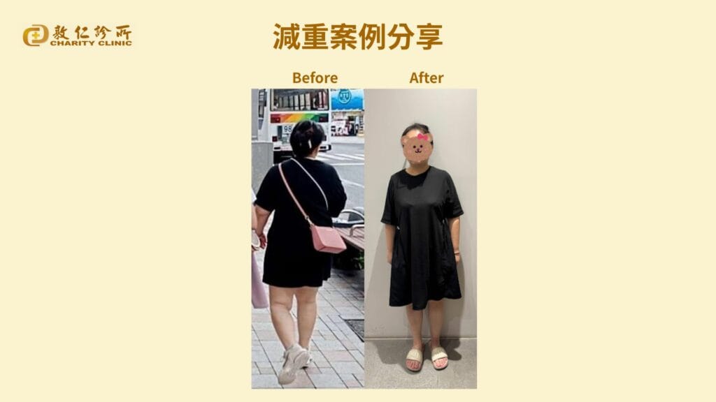 敦仁診所門診個案－怡惠－胰島素阻抗改善