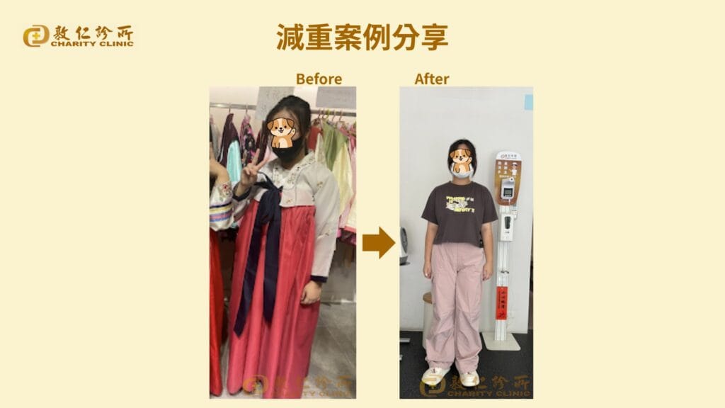 敦仁診所門診個案－曾小妹－13歲－兒童體重管理