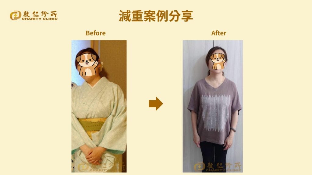 敦仁診所門診個案－楊小姐：兩個月減１０公斤