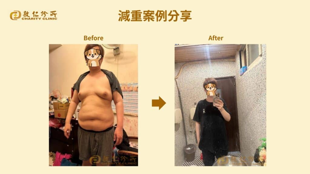 游先生-參加敦仁診所減重門診的前、後照片比對，半年減30.1公斤