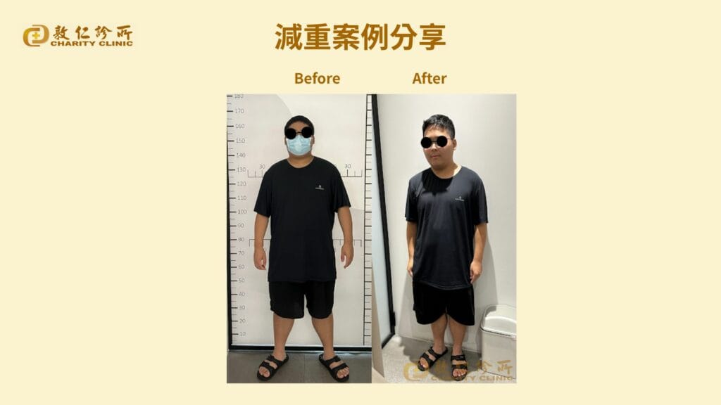 敦仁診所門診個案－馮先生－半年減２７公斤